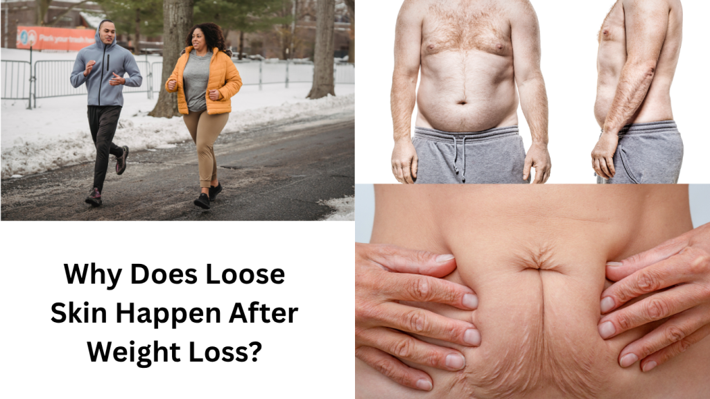 Why Does Loose Skin Happen After Weight Loss?