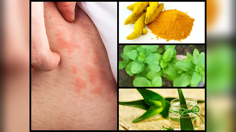 Treatment for Skin Allergy at Home